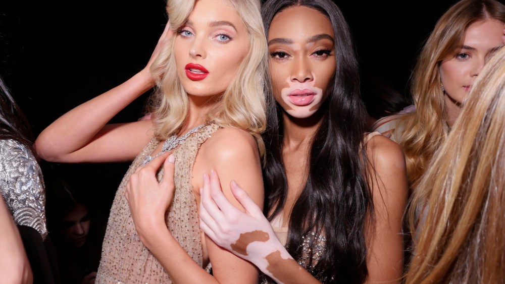 Elsa Hosk and Winnie Harlow