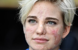Italian Paralympic Champion Beatrice Bebe Vio attends a press conference to present the Fencing Worlds 2017, on October 31, 2017 at Rome's Fiumicino airport. Rome will host the Wheelchair Fencing World Championship from November 6 to November 12, 2017.